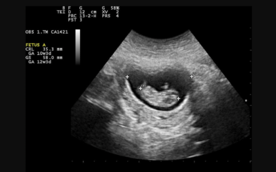 Jesus In The Womb: Month 3